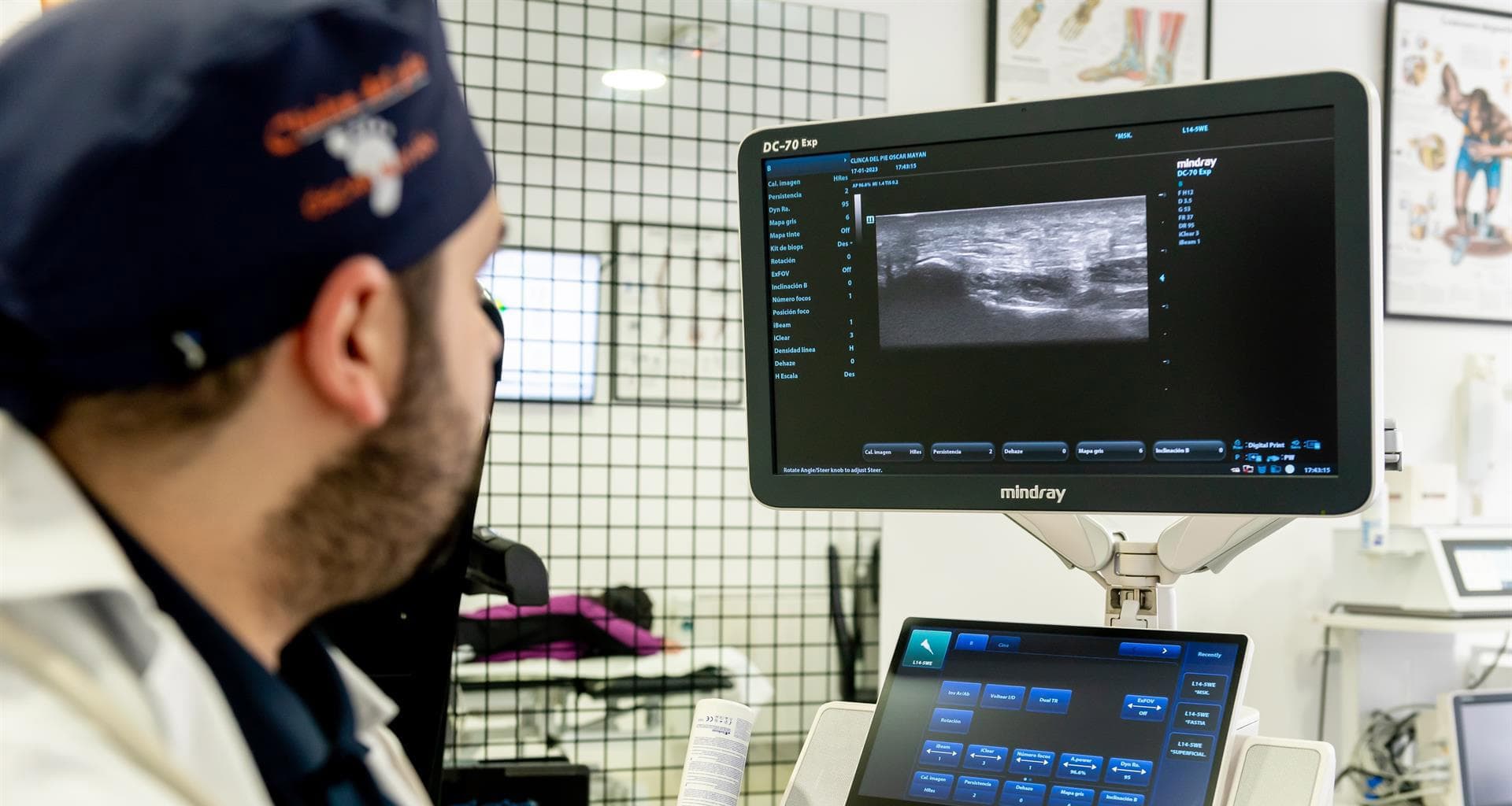 Análisis Biomecánico y Estudio de la Pisada en 3D